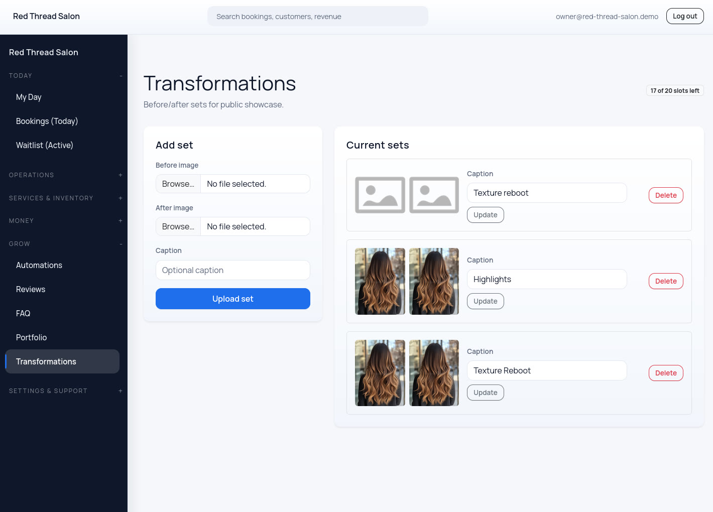 Before-and-after gallery management